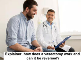 How does a vascetomy work Header