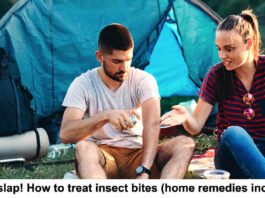 how to treat insect bites header
